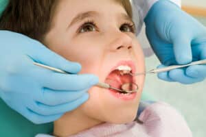 Frenectomy in Princeton, NJ Montgomery Pediatric Dentistry dentist in Princeton, NJ Dr. Christina Ciano Dr. Geena Russo Dr. Jammal
